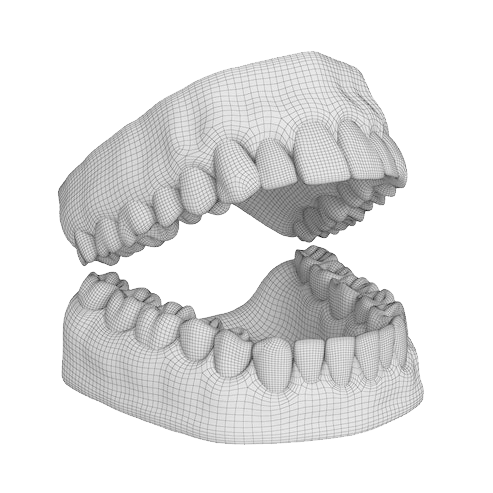 molde dental 3D